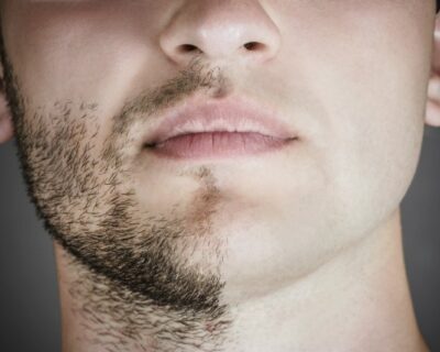 Les dangers du non ou mauvais rasage pour la santé