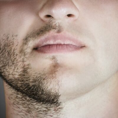Les dangers du non ou mauvais rasage pour la santé